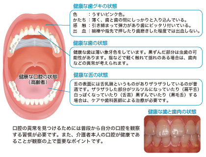 健康な歯と歯肉の状態